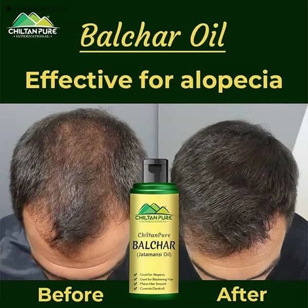 Balchar Shampoo