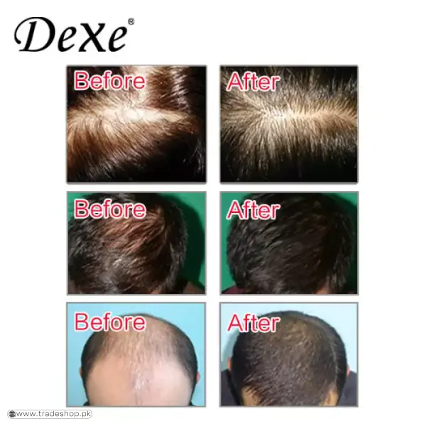 Dexe Hair Building Fibers