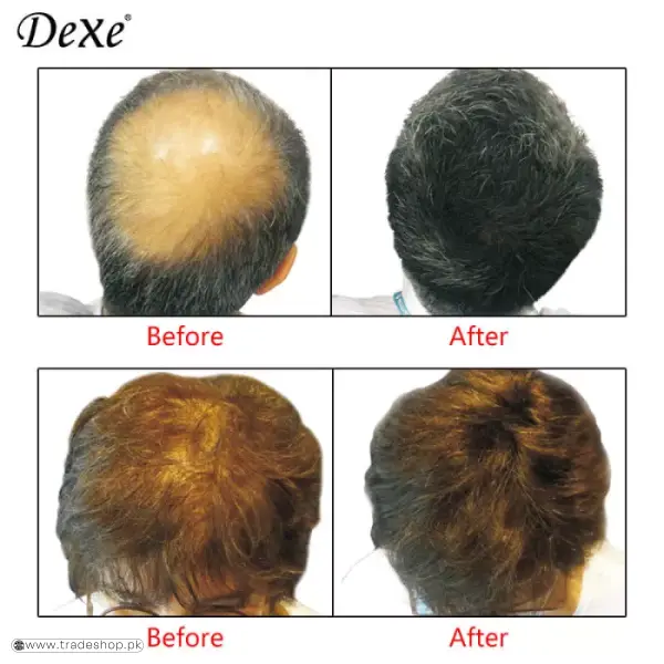 Dexe Hair Building Fibers