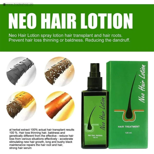 Neo Hair Lotion Oil Green Wealth